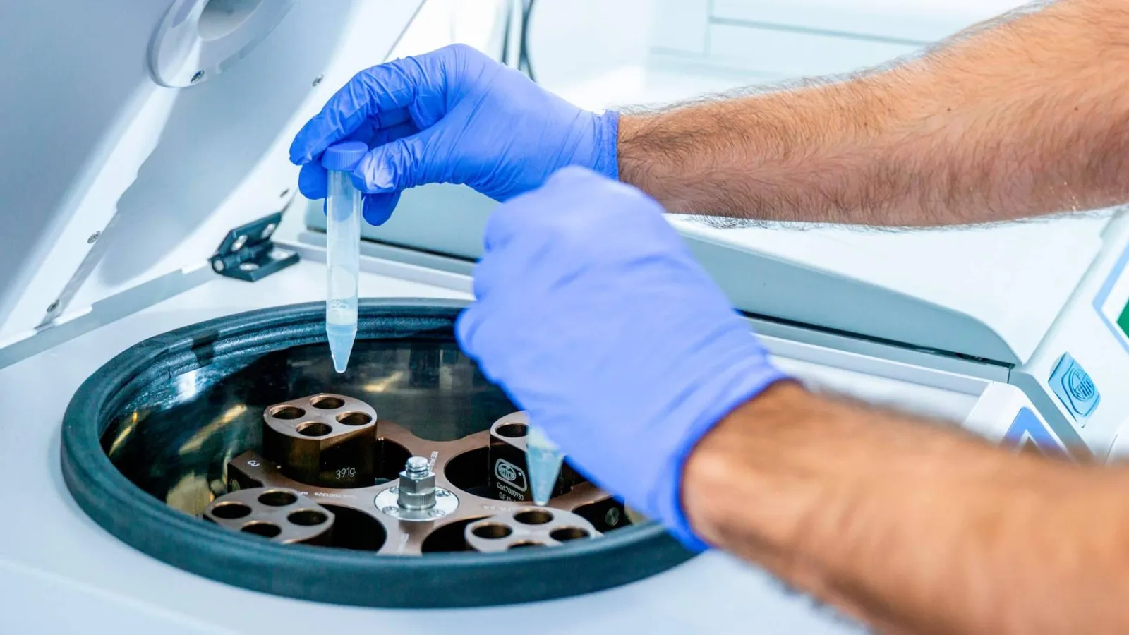 Preservar la fertilidad sin preocuparse por el tiempo de almacenamiento