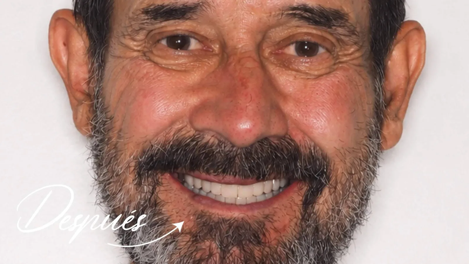 Clínica Calvo de Mora se consolida como referente en cirugía maxilofacial e implantología dental avanzada en Madrid