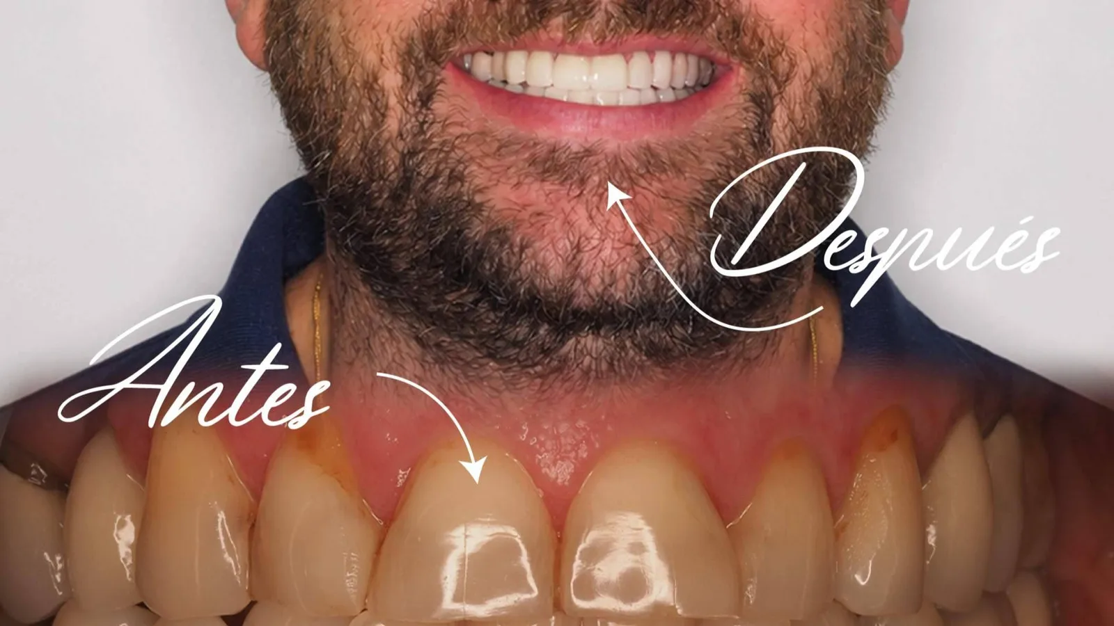 Clínica Calvo de Mora aplica tecnología avanzada en implantes dentales y cirugía maxilofacial